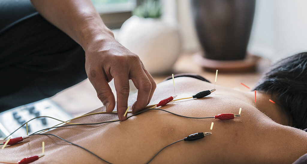 Electric Acupuncture Devices Market