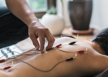 Electric Acupuncture Devices Market