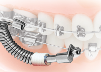 Endodontics and Orthodontics Market