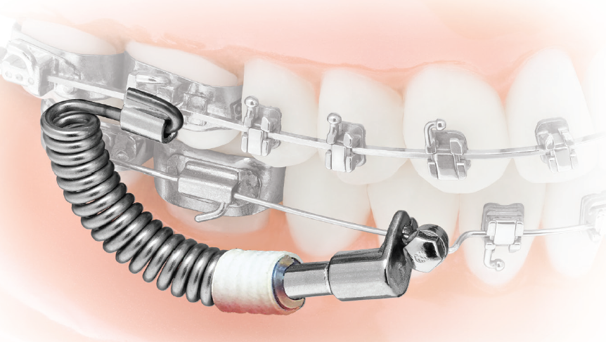 Endodontics and Orthodontics Market