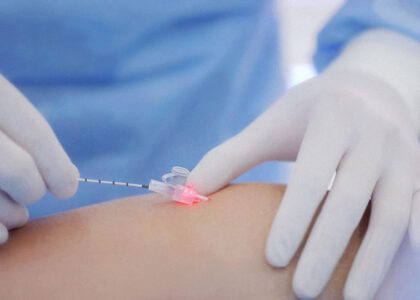 Endovenous Laser Therapy Market