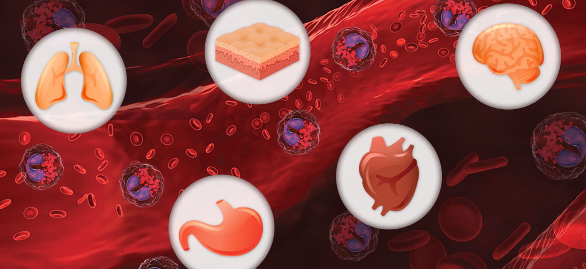 Eosinophilic Granulomatosis with Polyangiitis Treatment Market