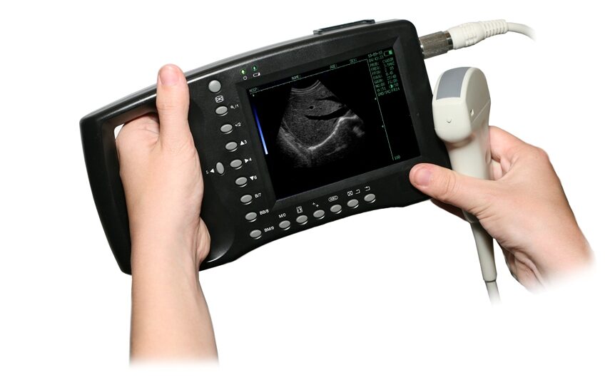 Handheld Ultrasound Scanner Market