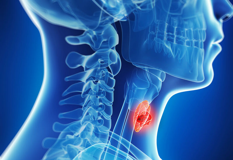 Hypoparathyroidism Treatment Market