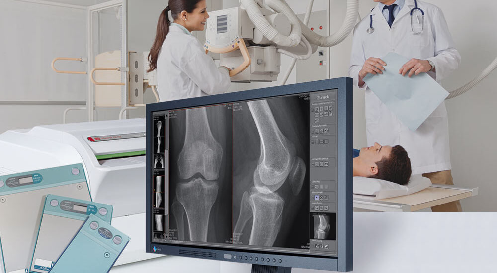 Intracardiac Imaging Market