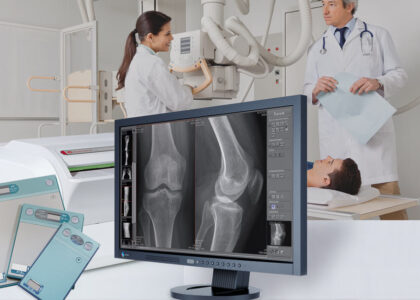 Intracardiac Imaging Market