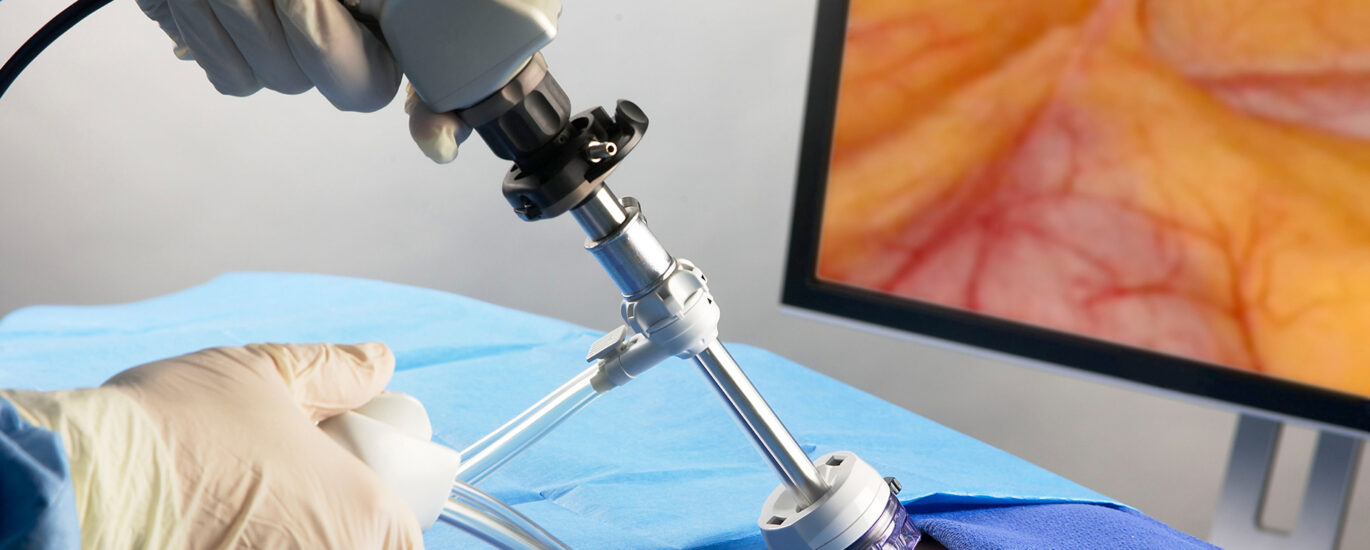 Mobile Endoscopic Workstations Market