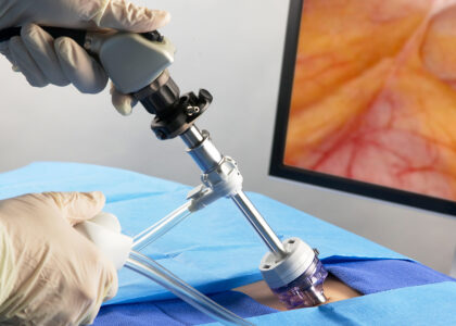 Mobile Endoscopic Workstations Market