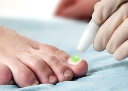 Onychomycosis Treatment Market