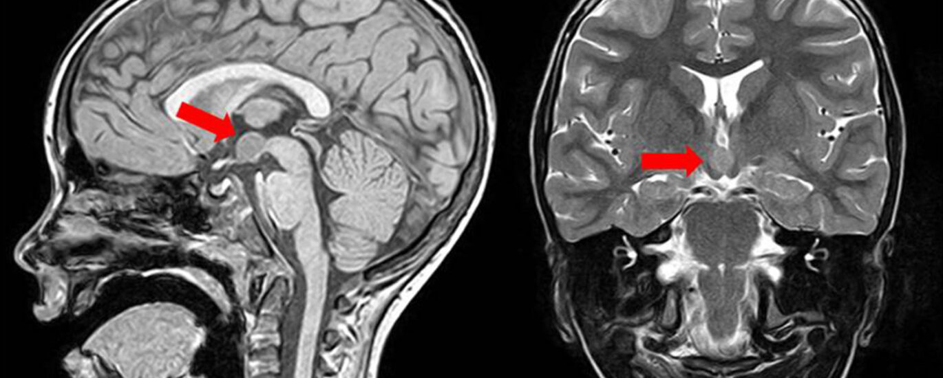 Perfusion Imaging Market