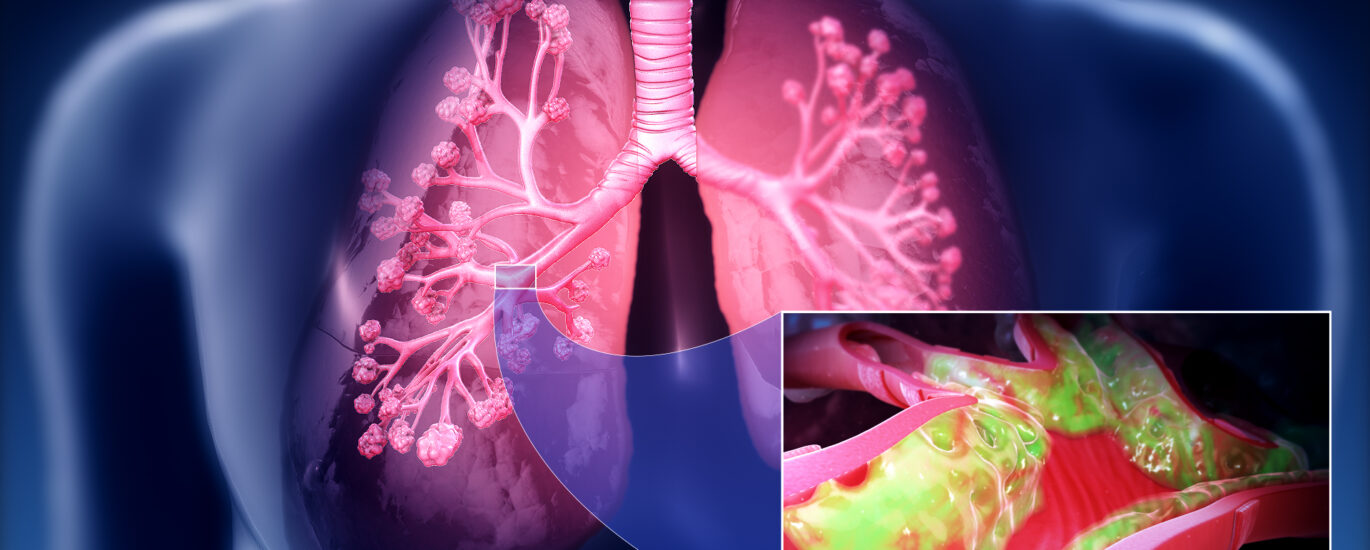 Portal Hypertension Management Market