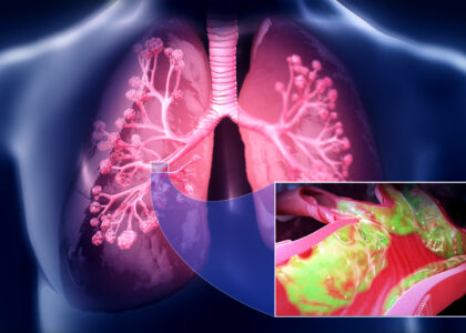 Portal Hypertension Management Market