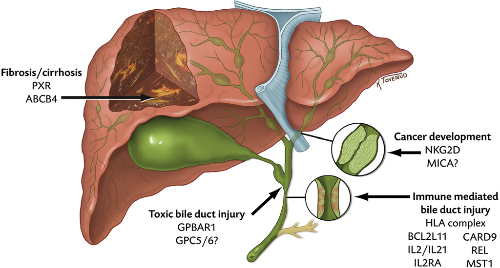 Primary Sclerosing Cholangitis (PSC) Market