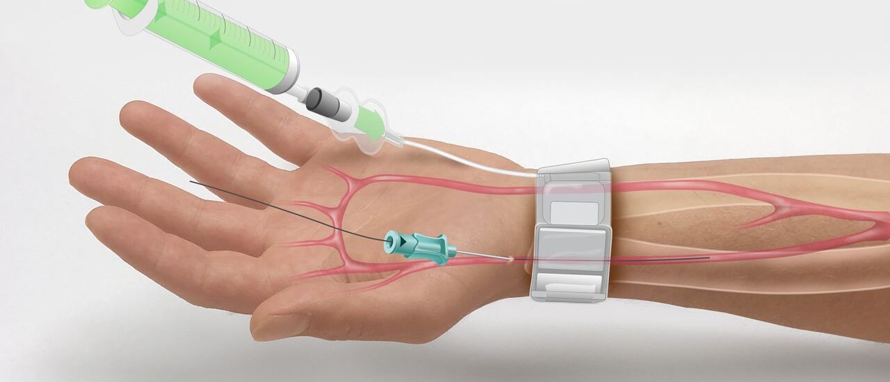 Radial Compression Devices Market