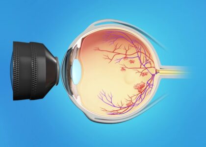 Retinal Vein Occlusion Treatment Market