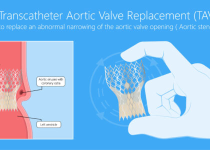 Transcatheter Heart Valve Replacement (TAVR) Market