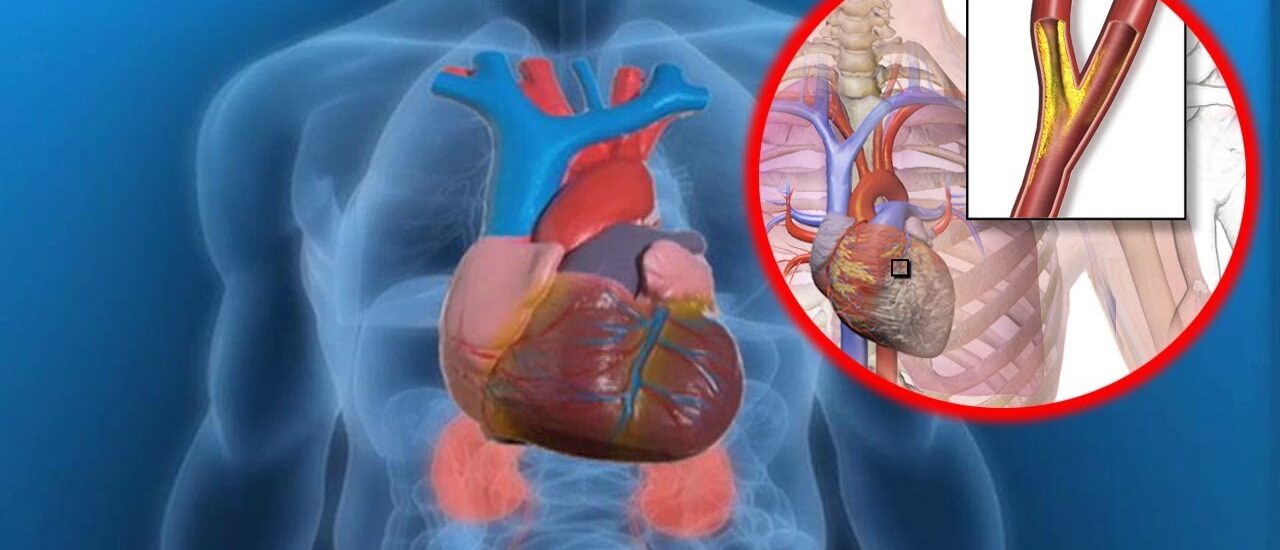 Unstable Angina Therapeutics Market