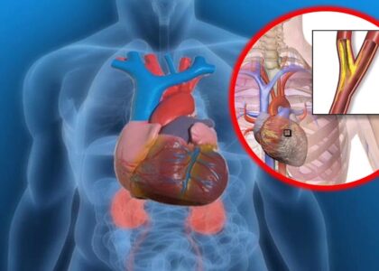 Unstable Angina Therapeutics Market