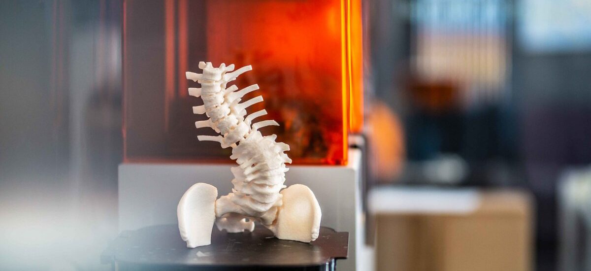 3D Printed Surgical Models Industry