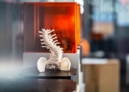 3D Printed Surgical Models Industry