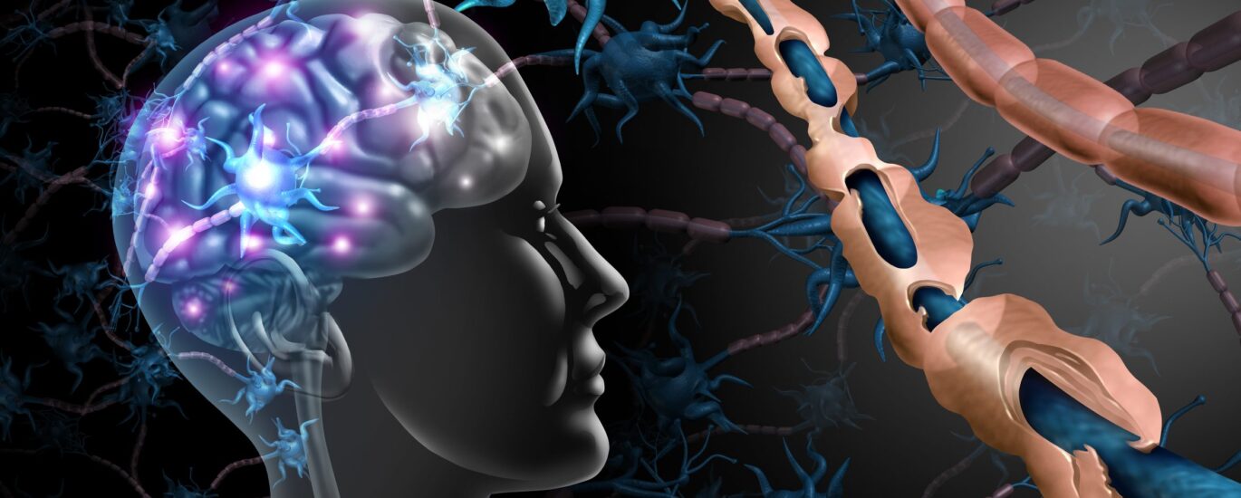 Alzheimer's Diagnostics and Therapeutics Industry