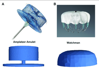 Atrial Appendage Occluder Industry