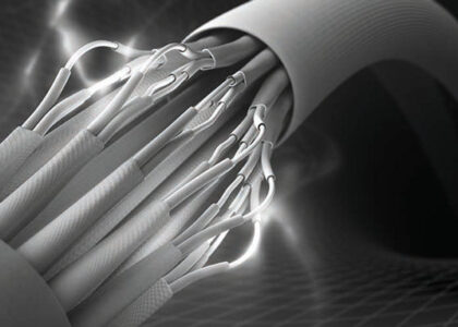 Conductive Fibers Industry