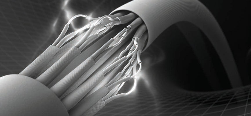 Conductive Fibers Industry