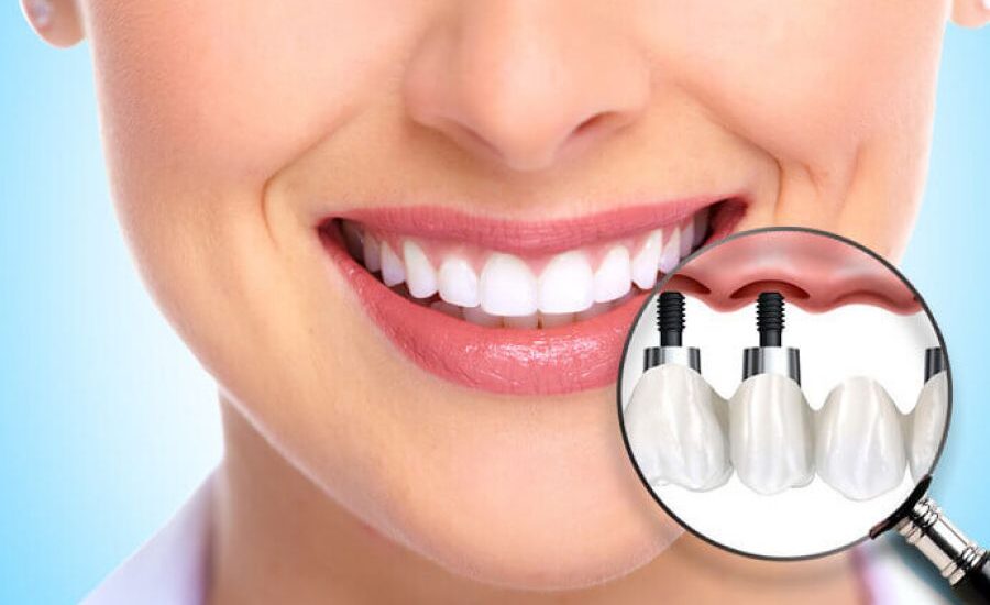 Cosmetic Implants Market