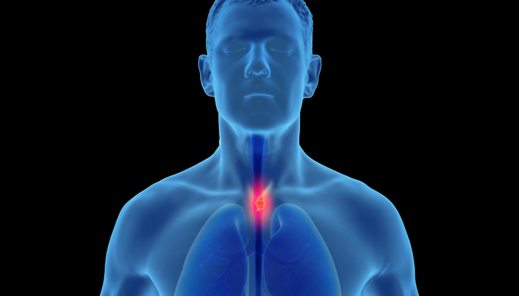 Eosinophilic Esophagitis Market