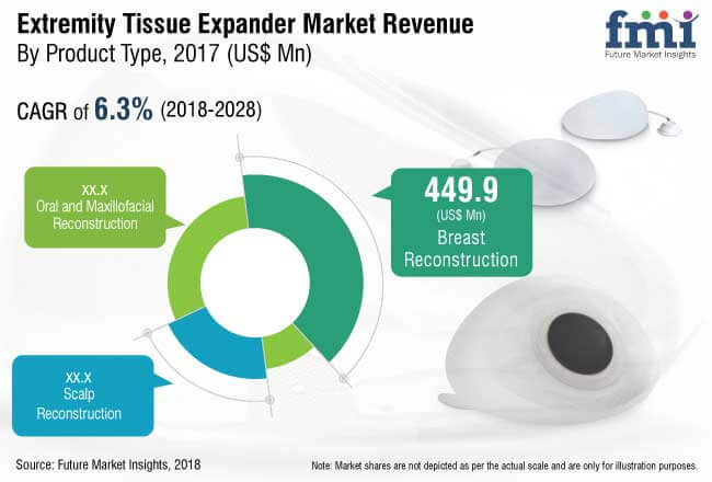 Extremity Tissue Expanders Industry