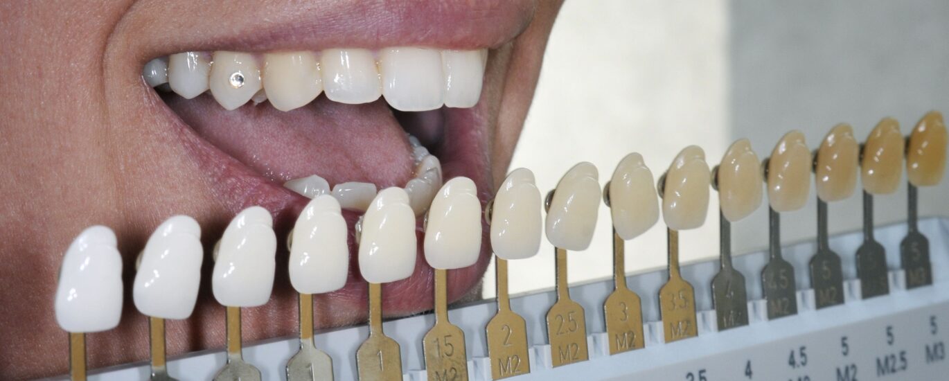 Global Acrylic Teeth Industry