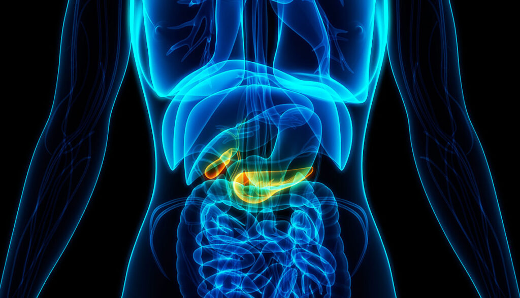 Global Pancreatic Cancer Market