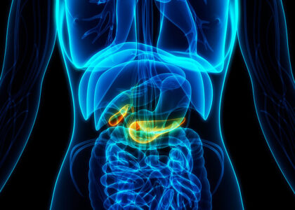 Global Pancreatic Cancer Market