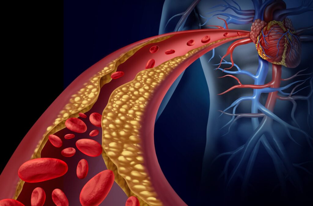 HDL Cholesterol Kits Market