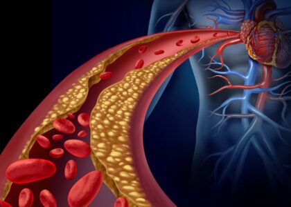 HDL Cholesterol Kits Market