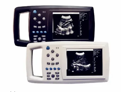 Handheld Ultrasound Scanners Market