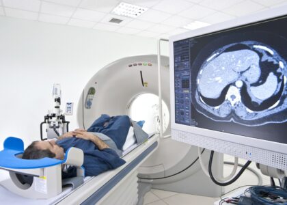 Intracardiac Imaging Market