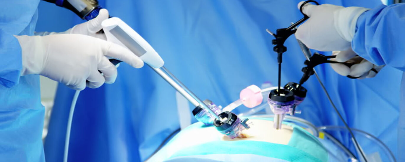 Laparoscopic Device Market