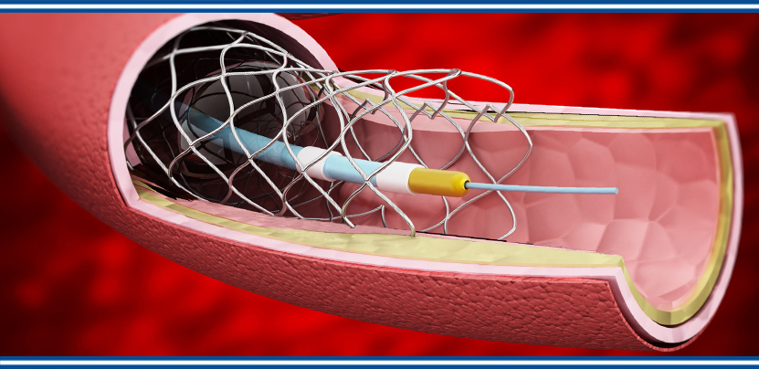 Peripheral Vascular Devices Market