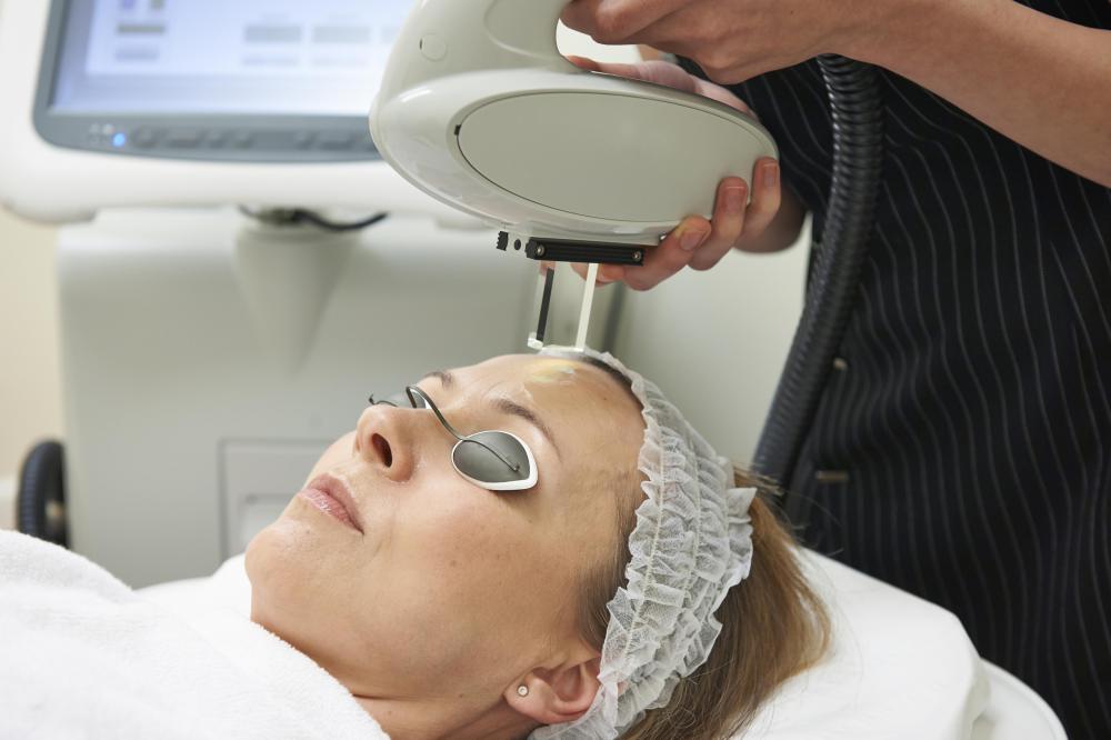 Photorejuvenation Equipment Market