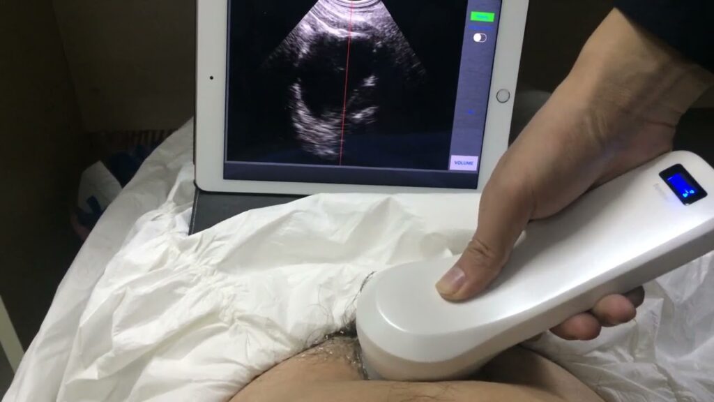 Portable Ultrasound Bladder Scanner Market