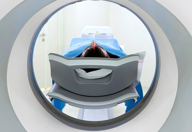 Precision Cancer Imaging Market