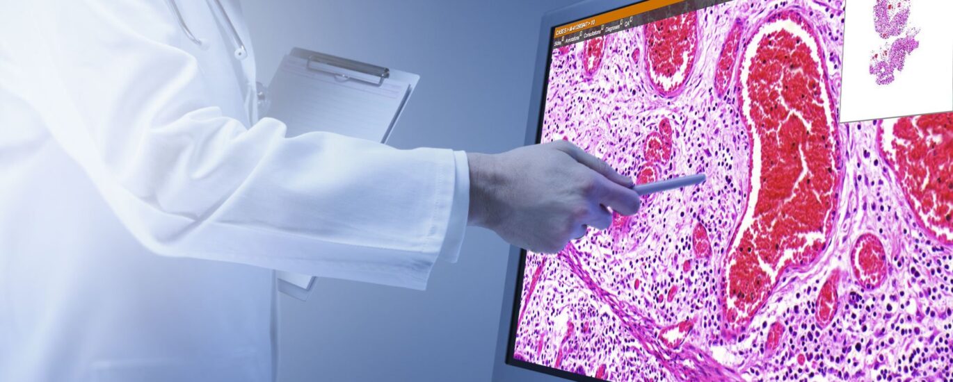 Quantitative Pathology Imaging Market