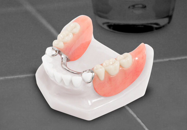 Removable Partial Dentures Market