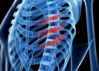 Rib Fracture Repair Systems Market