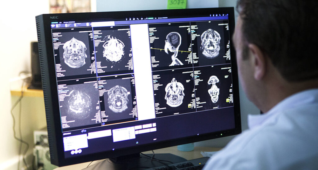 Teleradiology Market