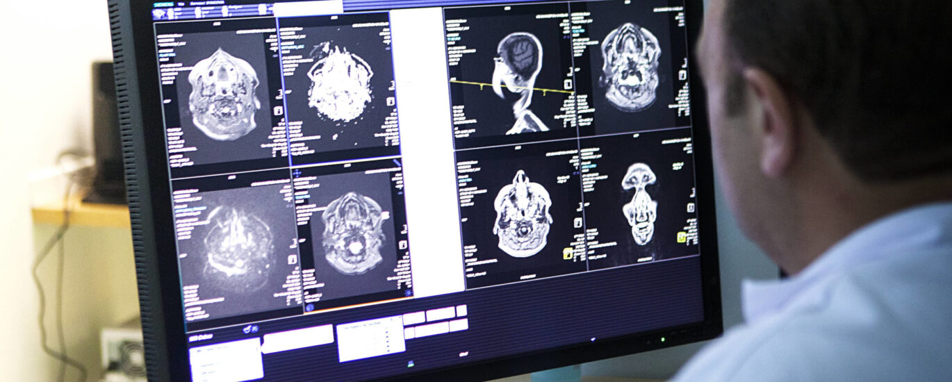 Teleradiology Market