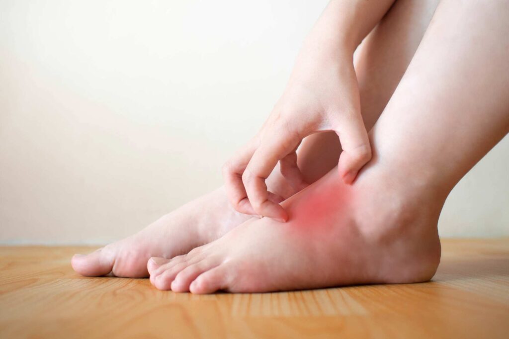 Tinea Pedis Treatment Market