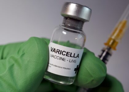 Varicella Zoster Infection Treatment Industry